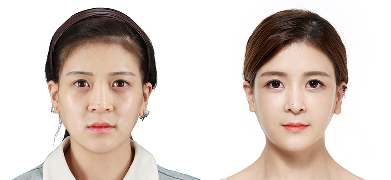 Slider image (2) JK Plastic Surgery